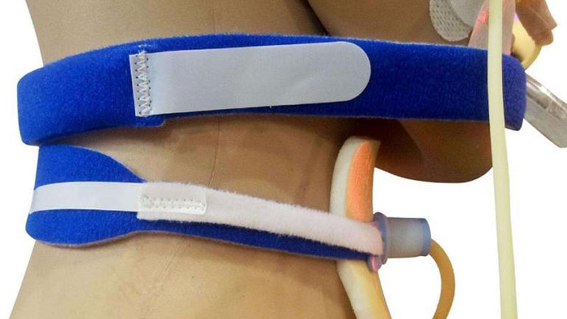 Soporte para Tubo de Traqueostomía